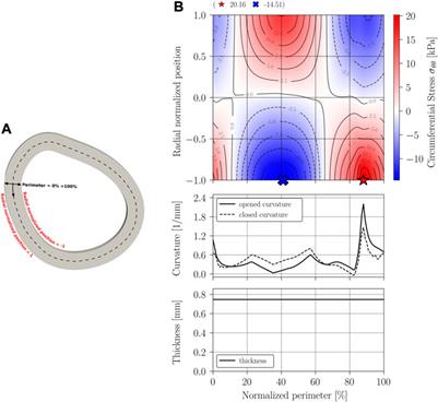 Analysis of the geometrical influence of ring-opening samples on arterial circumferential residual stress reconstruction